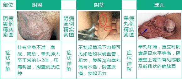 【火速解救】 男人,为自己储蓄健康,为孩子储蓄未来 上海九龙男子医院采取的治疗方案适用于上述症状人群,最新数据验证:精索静脉曲张患者术后精液 治 疗改善率为70%-90%,受孕率为60%-80%,重建精索静脉血流血液循环 ,提高精子质量,可实现自然孕育。(即日起至2015-12-31,凡行手术者可直接体验手术援助活动 ,惠后费用与一般性手术费用相当,即刻预约 >>>)